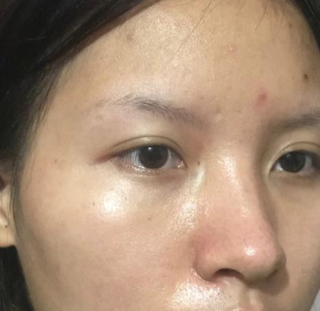 油性皮膚會(huì)一輩子油嗎，油性皮膚不容易衰老為什么